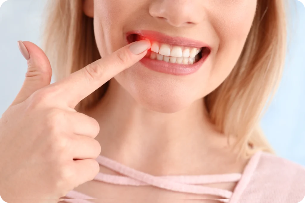 parodontologie metz consultation Conseils post-opératoires Dentistes à Metz | Esthétique dentaire | Cabinet dentaire des Ormes