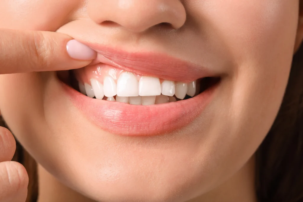 soins gencives metz Soins dentaries Dentistes à Metz | Esthétique dentaire | Cabinet dentaire des Ormes